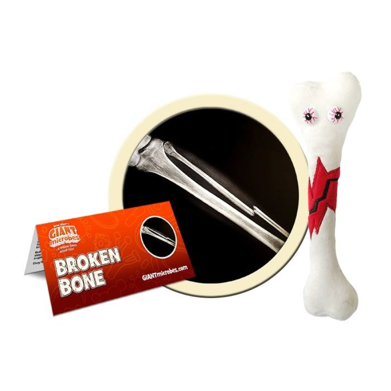 Broken Bone Plush Giant Microbe